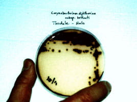 Corynebacterium diphtheriae subsp. belfanti. Michigan. 1997.