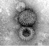 Human Rotavirus. Michigan. 1998.  Margaret Casey, Laboratory Scientist.