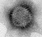 Adenovirus. Michigan. 2001. Margaret Casey, Laboratory Scientist.