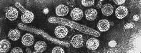 Hepatitis B from Linda Stannard, Department of Medical Microbiology, University of Cape Town, by way of The Big Virology Picture Book