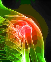 shoulder x-ray