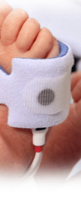 pulse oximetry pulse oximetry