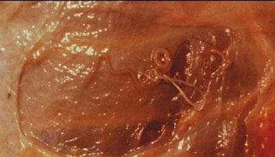 photo of bear filarial worm
