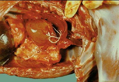 heartworm parasite