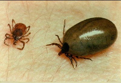 ticks (the tick on the right is engorged with blood)