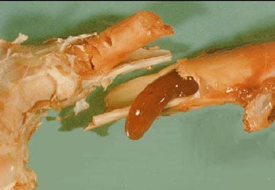 normal bone marrow (top left), jelly-like bone marrow seen with starvation (lower right)