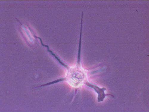 Amoeba 40X