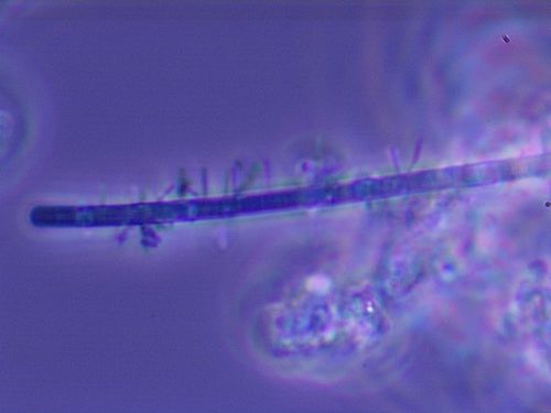 Type 0041 filamentous bacteria 100X