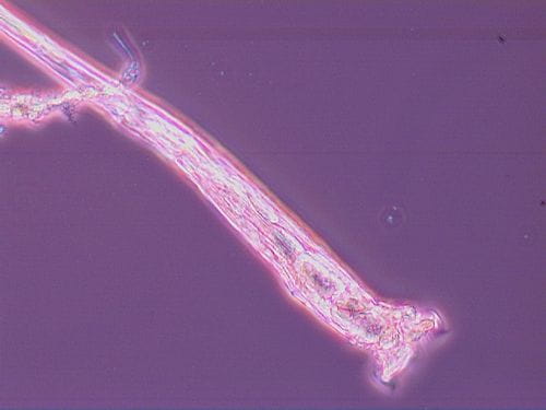 Rotifer - extended 10X