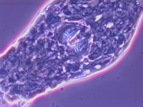 Mastix of Rotifer 40X