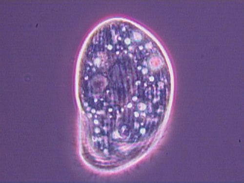 Ciliate Chilodonella 160 microns 40X