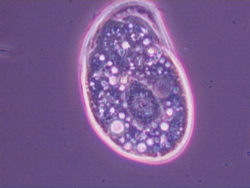 Ciliate Chilodonella 160 microns 40X