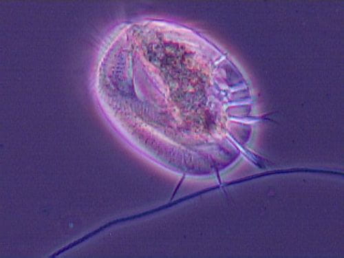 Ciliate Euplotes 40X