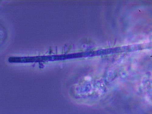 Type 0041 filamentous bacteria 100X