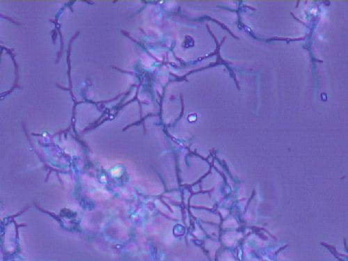 Nocardia filamentous bacteria 40X