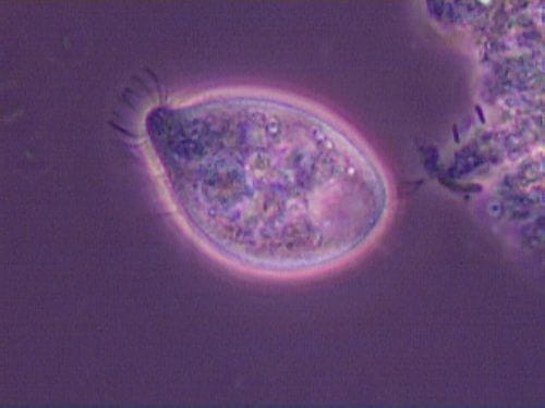 Ciliate Trachelophyllum 10 microns 100X