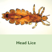 Head Lice Placeholder Image