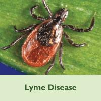 Lyme Disease placeholder image