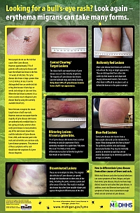 Looking for a bull's-eye rash poster