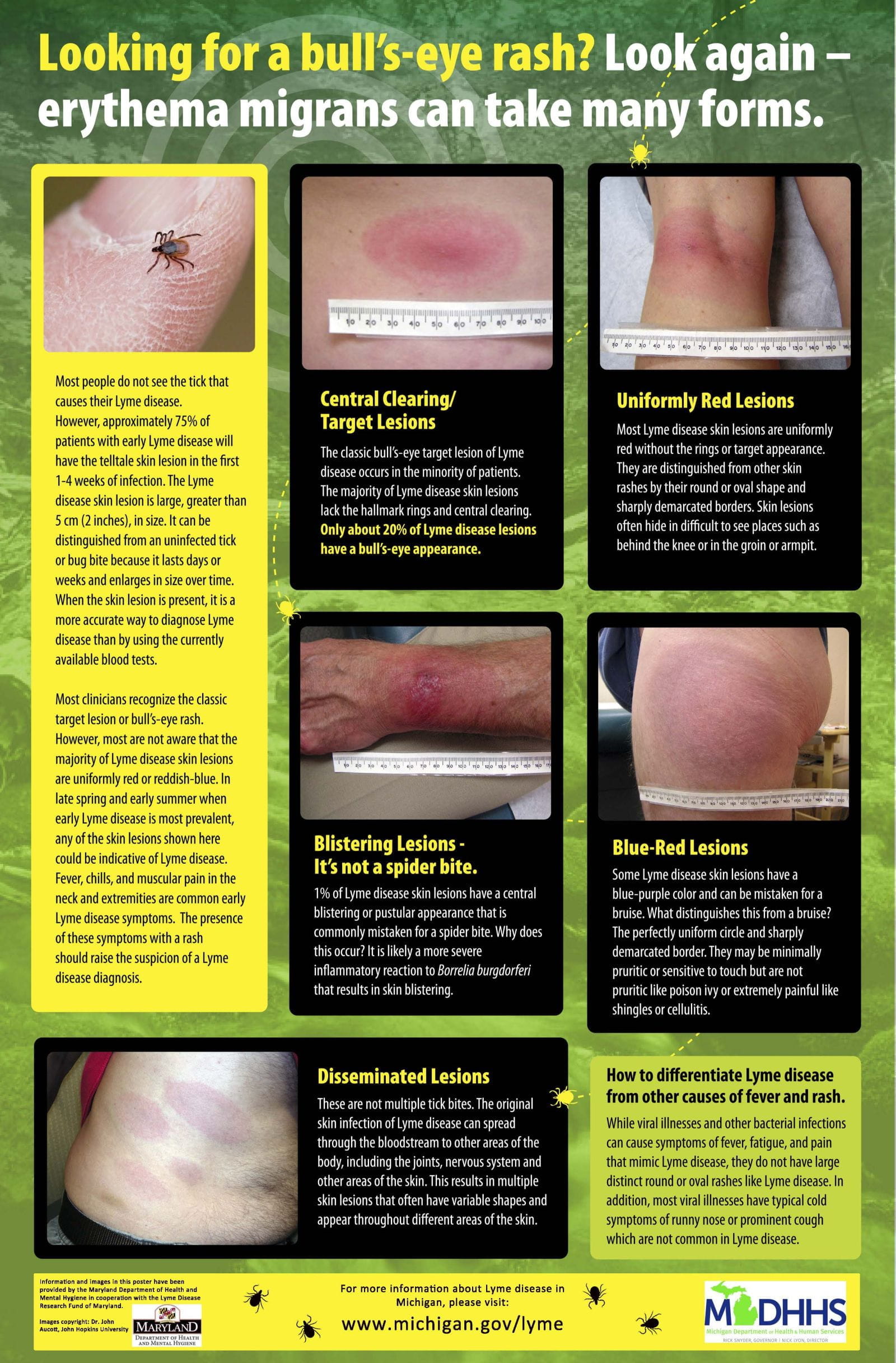 Bullet Rash Symptoms