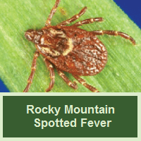 Rocky Mountain Spotted Fever