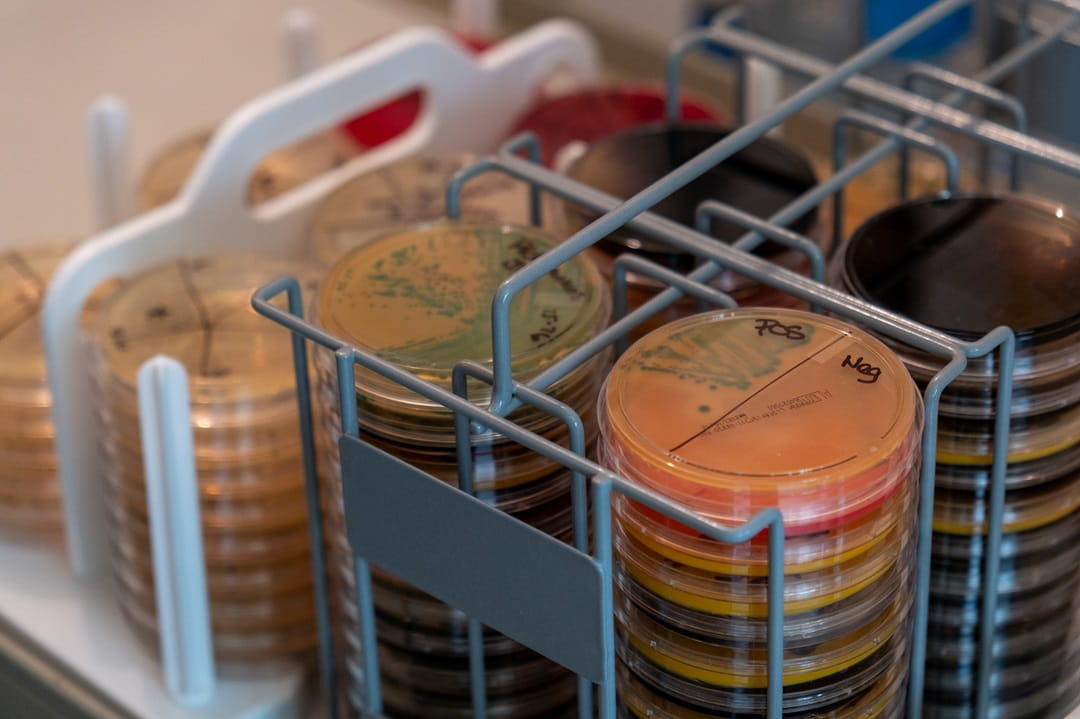 A stack of petri dishes with active test cultures, some showing positive and some showing negative.