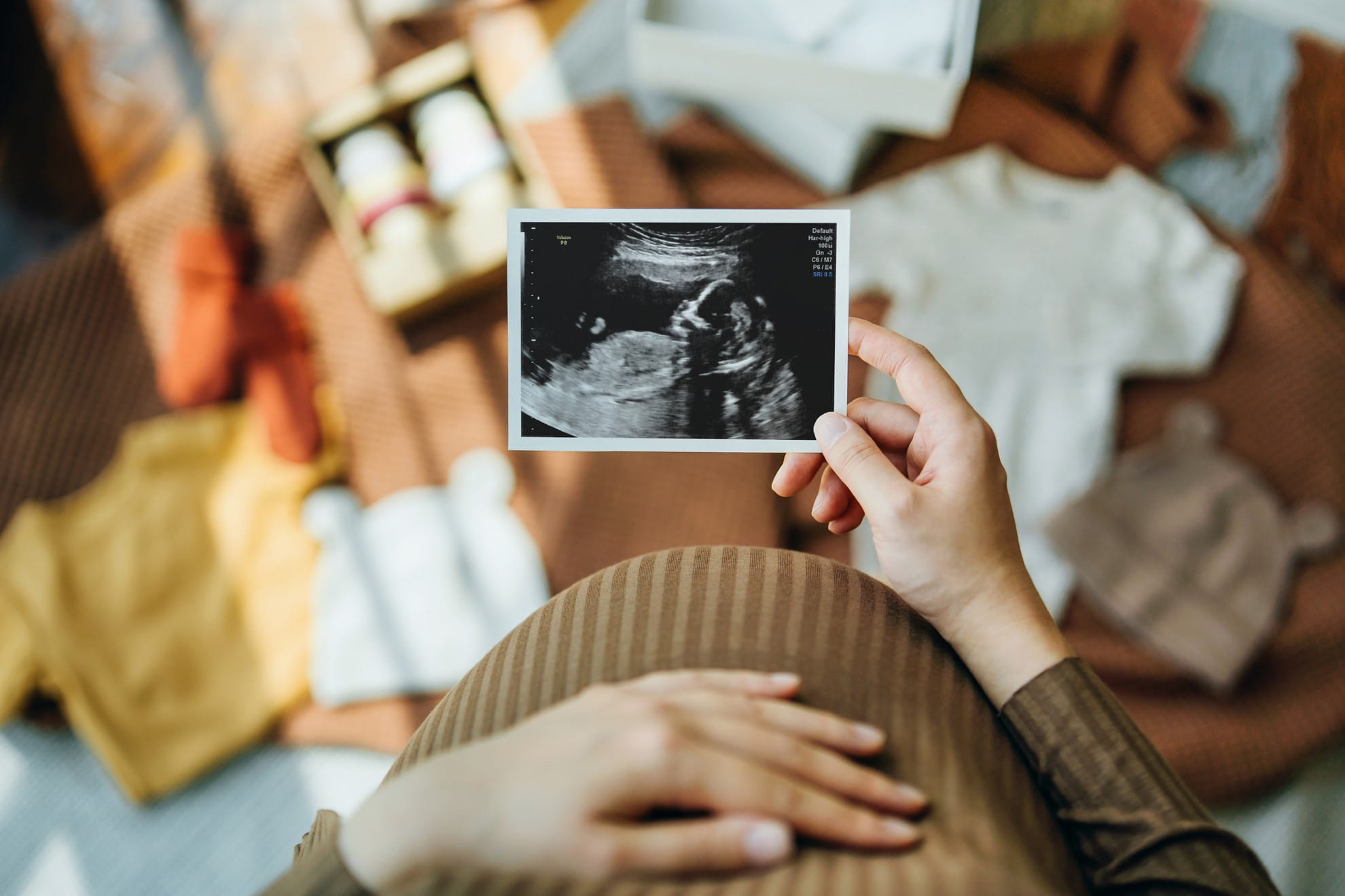 top down view of pregnant belly with sonogram
