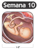 Semana 10