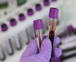 Blood sample vials