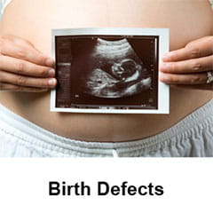 birth defects
