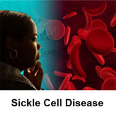 Sickle Cell 