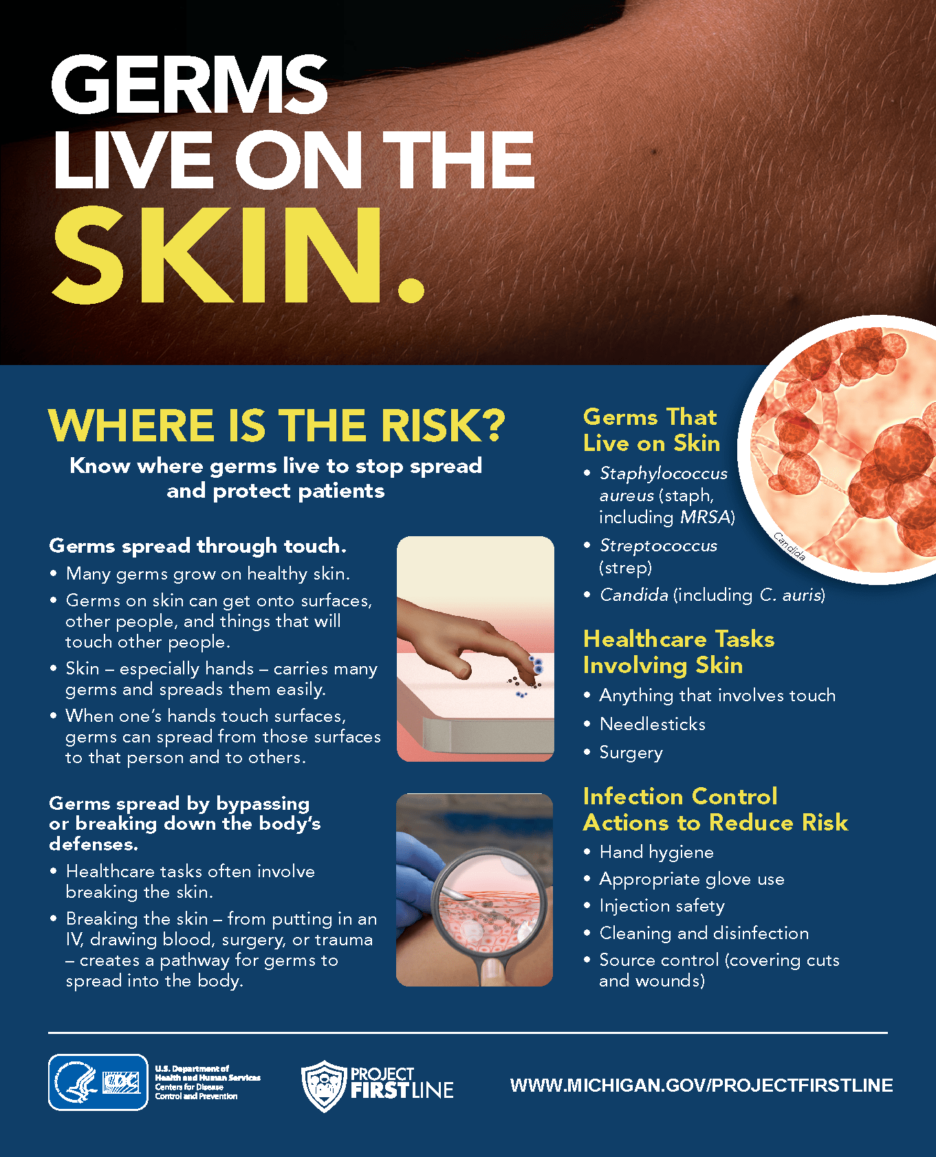 Germs Live on Skin Image