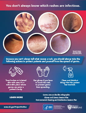 Micro Learn Rash Thumbnail