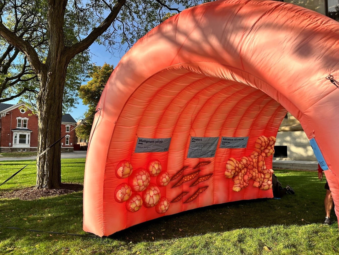 The Michigan Colorectal Cancer Control Program inflatable colon visits Intercare-Benton Harbor during Colorectal Cancer Awareness Month 2024.
