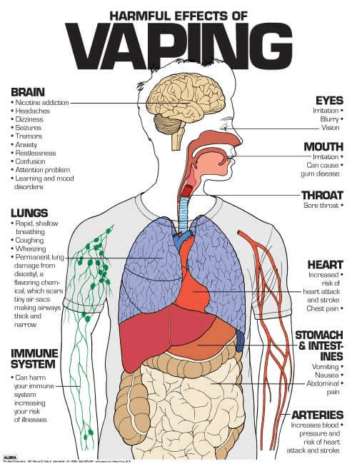 Harmful effects of vaping poster (available from nimcoinc.com)