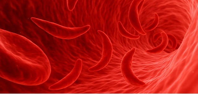 red blood cells, some sickled