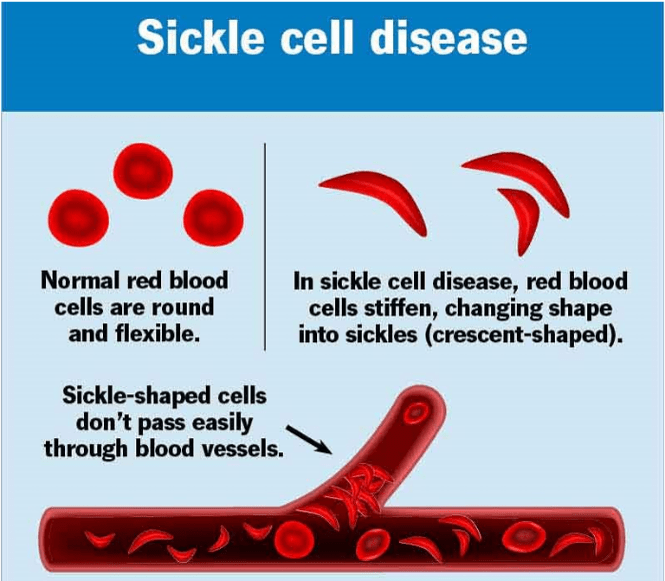 Diagram showing blood flow through veins