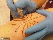An image of someone branding a butterfly on someone's arm.