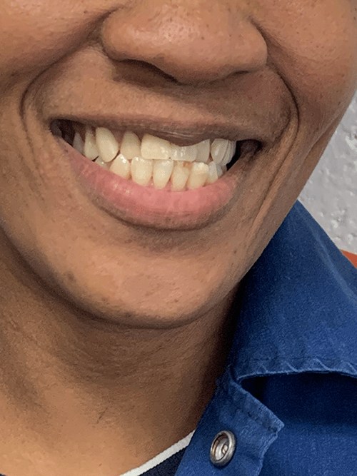 2025-Denture Pic-Web