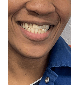 2025-Denture Pic-Web