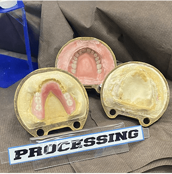 Processing Set-UP
