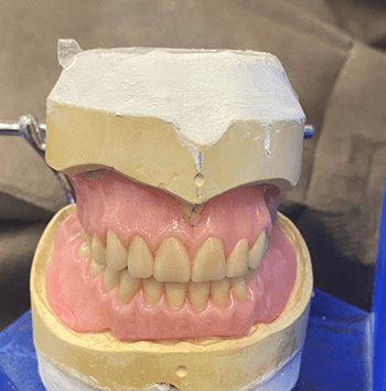 Denture Display