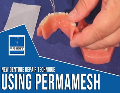 Dental Perma Mesh-Panel Pic