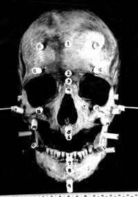 Skull with tissue depth markers