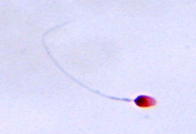 Spermatozoa Under Magnification