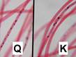 Trace Fiber evidence under magnification