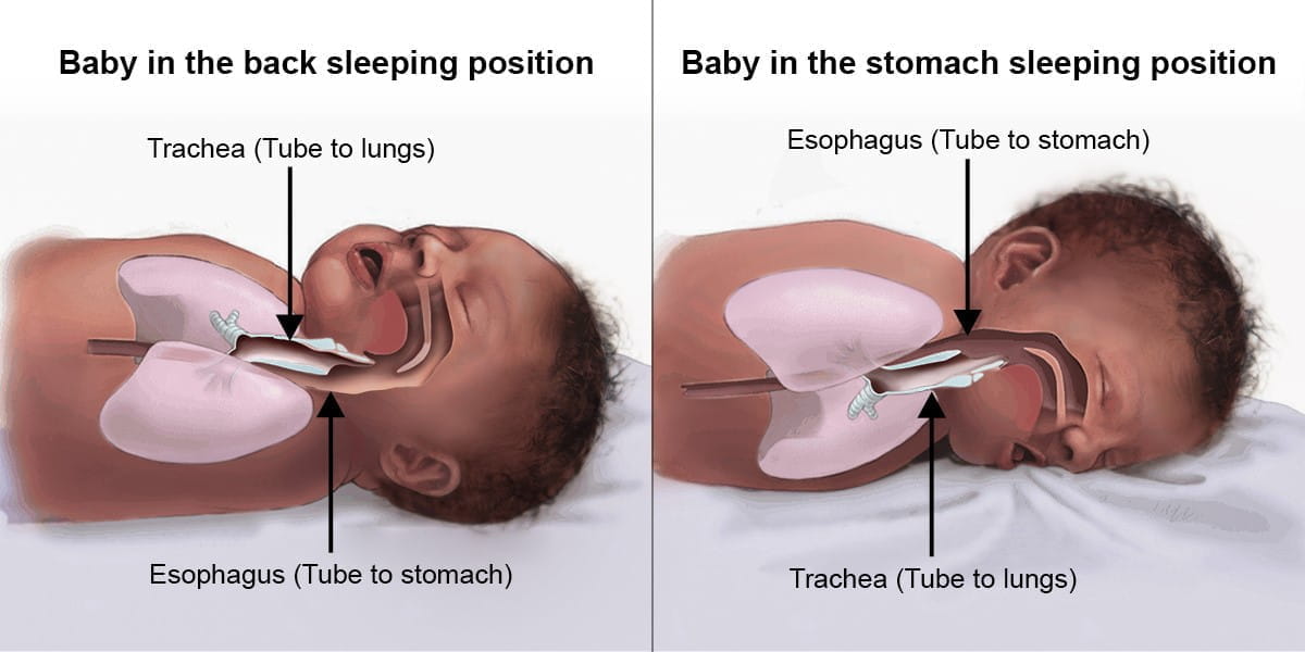 a diagram explaining why sleeping on their back is safer for babies