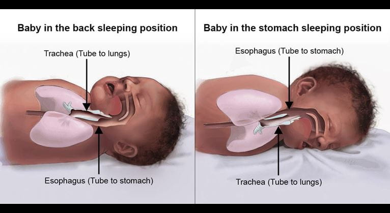 a diagram explaining why sleeping on their back is safer for babies