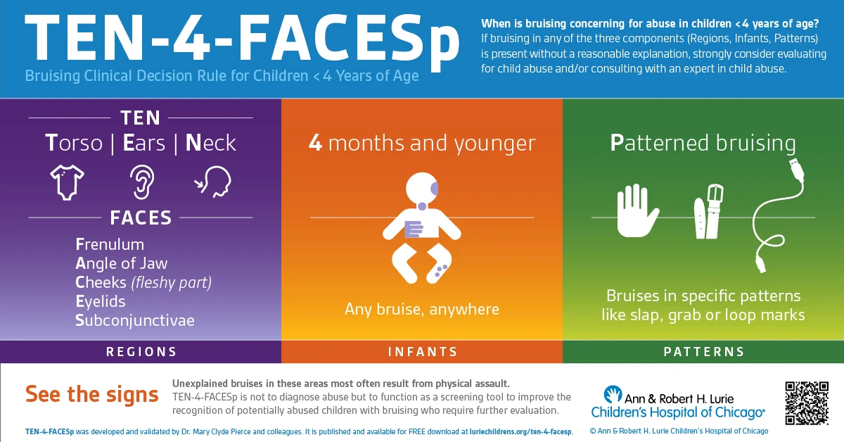 TEN-4-FACESp image with information on identifying child abuse in kids under 4