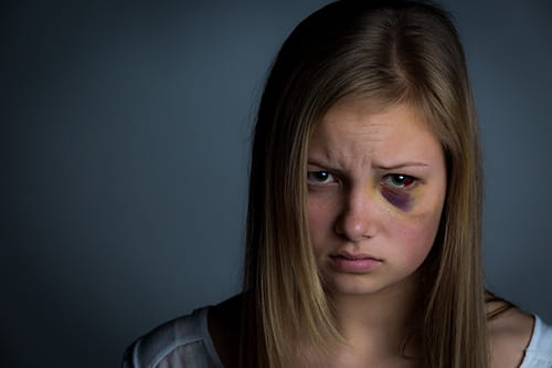 Young Girl experiencing child abuse